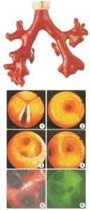 “康為醫(yī)療”CLA9/8熒光氣管支氣管樹模型(消化內(nèi)科技能模型）