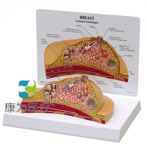 “康為醫(yī)療”醫(yī)患關(guān)系溝通模型-乳房橫斷切面模型 （醫(yī)學(xué)指導(dǎo)模型）